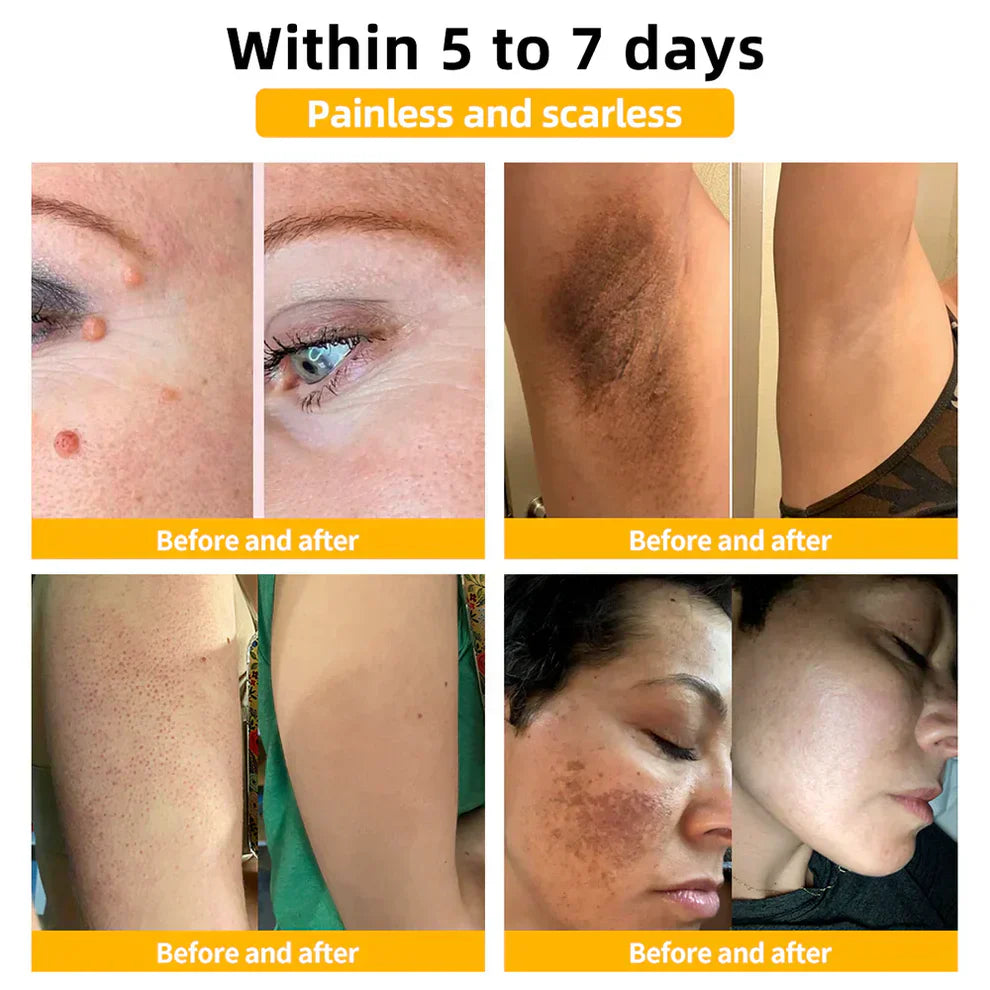 Zavinox Bee Venom Skin Treatment Cream