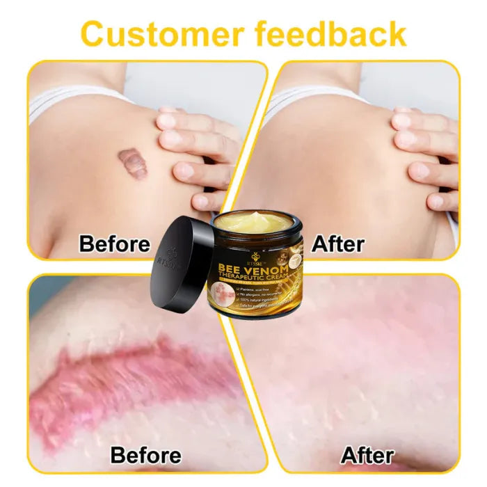 Zavinox Bee Venom Skin Treatment Cream